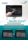 Технология улучшения визуализации биопсийной иглы Needle Vision™
